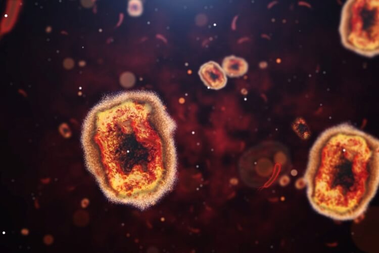 Monkeypox in CT: What to know